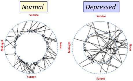 La depressione e l’alterazione del sonno